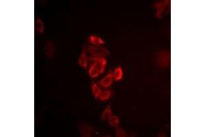 Immunofluorescent analysis of Connexin 40 staining in HepG2 cells. (Cx40/GJA5 Antikörper)