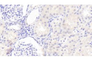Detection of TSLP in Human Kidney Tissue using Polyclonal Antibody to Thymic Stromal Lymphopoietin (TSLP) (Thymic Stromal Lymphopoietin Antikörper  (AA 29-159))