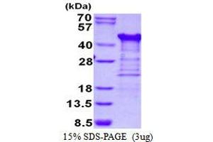 Tetratricopeptide Repeat Domain 1 (TTC1) protein (His tag)