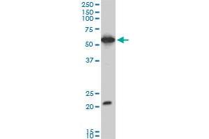 EBF3 monoclonal antibody (M06), clone 1G3. (EBF3 Antikörper  (AA 381-480))