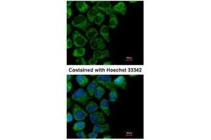 ICC/IF Image Immunofluorescence analysis of methanol-fixed A431, using OAT, antibody at 1:200 dilution. (OAT Antikörper)