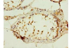Immunohistochemistry of paraffin-embedded human testis tissue using ABIN7174888 at dilution of 1:100 (C7orf61 Antikörper  (AA 1-206))