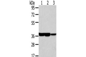 Western Blot analysis of Human fetal brain and placenta tissue, Mouse brain tissue using TALDO1 Polyclonal Antibody at dilution of 1/400
