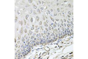 Immunohistochemistry of paraffin-embedded human esophagus using RHOT1 antibody (ABIN5973450) at dilution of 1/100 (40x lens). (RHOT1 Antikörper)