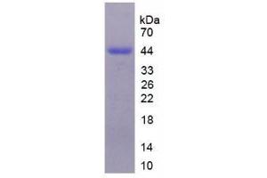Image no. 1 for serpin Peptidase Inhibitor, Clade D (Heparin Cofactor), Member 1 (SERPIND1) (AA 256-342) protein (His tag,GST tag) (ABIN6236623) (SERPIND1 Protein (AA 256-342) (His tag,GST tag))
