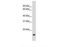 Image no. 1 for anti-Regulator of G-Protein Signaling 2 (RGS2) (AA 101-150) antibody (ABIN203516) (RGS2 Antikörper  (AA 101-150))