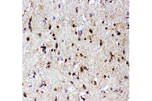Anti-p73 antibody, (ABIN3043469), IHC(P)IHC(P): Rat Brain Tissue (Tumor Protein p73 Antikörper  (AA 1-198))