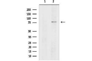 anti-Cyclic Nucleotide Gated Channel alpha 2 (CNGA2) (C-Term) antibody