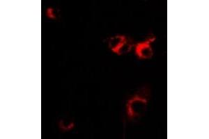 Immunofluorescent analysis of IL-1RA staining in MCF7 cells. (IL1RN Antikörper)