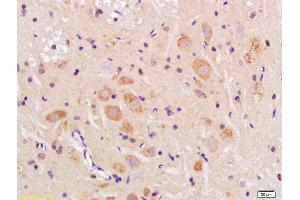 Formalin-fixed and paraffin embedded rat brain labeled with Anti-TMEM158 Polyclonal Antibody, Unconjugated (ABIN1386582) at 1:200 followed by conjugation to the secondary antibody and DAB staining (TMEM158 Antikörper  (AA 188-260))