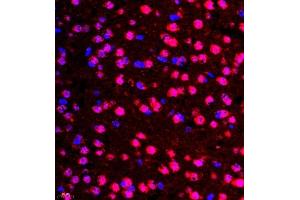 Immunofluorescence (Paraffin-embedded Sections) (IF (p)) image for anti-Colony Stimulating Factor 1 (Macrophage) (CSF1) antibody (ABIN7073553)
