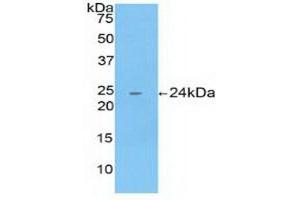Detection of Recombinant CTSB, Human using Polyclonal Antibody to Cathepsin B (CTSB) (Cathepsin B Antikörper  (AA 129-333))