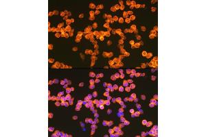 Immunofluorescence analysis of Jurkat cells using Z Rabbit mAb (ABIN7271430) at dilution of 1:100 (40x lens). (ZAP70 Antikörper)