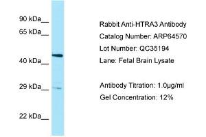 Western Blotting (WB) image for anti-HtrA Serine Peptidase 3 (HTRA3) (Middle Region) antibody (ABIN2789881) (HTRA3 Antikörper  (Middle Region))