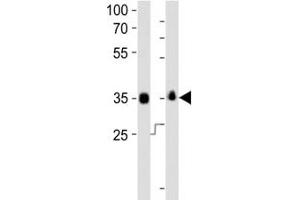 Western blot analysis of lysate from human NCCIT, mouse F9 cell line (left to right) using anti-SOX-2 antibody at 1:1000 for each lane. (SOX2 Antikörper  (AA 6-39))
