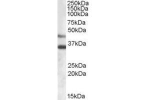 Image no. 1 for anti-Arylsulfatase B (ARSB) (Internal Region) antibody (ABIN374887) (Arylsulfatase B Antikörper  (Internal Region))