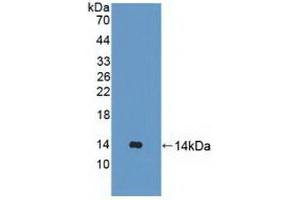 Detection of Recombinant UBQLN2, Human using Polyclonal Antibody to Ubiquilin 2 (UBQLN2) (Ubiquilin 2 Antikörper  (AA 33-126))