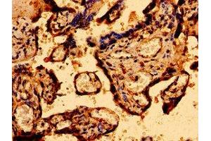 Immunohistochemistry of paraffin-embedded human placenta tissue using ABIN7146314 at dilution of 1:100 (MCU Antikörper  (AA 155-233))