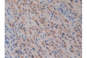 Immunohistochemistry (IHC) image for anti-Slit Homolog 1 (SLIT1) (AA 603-773) antibody (ABIN7438100)