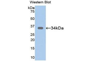 Western blot analysis of the recombinant protein. (SFRP1 Antikörper  (AA 32-314))