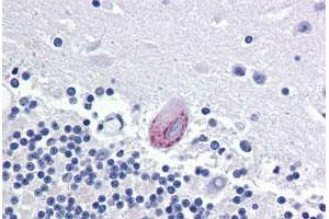 Immunohistochemical staining of human brain, cerebellum with LPCAT1 polyclonal antibody . (LPCAT1 Antikörper  (Internal Region))