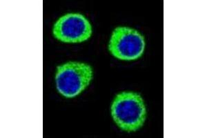 Confocal immunofluorescent analysis of CPSF3L  Antibody  with U-251MG cell followed by Alexa Fluor 488-conjugated goat anti-rabbit lgG (green).