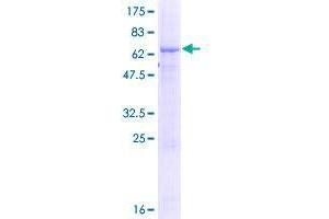 Image no. 1 for Tetratricopeptide Repeat Domain 23-Like (TTC23L) (AA 1-361) protein (GST tag) (ABIN1324007) (TTC23L Protein (AA 1-361) (GST tag))