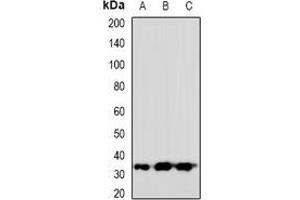 Western blot analysis of VGLL2 expression in HeLa (A), mouse heart (B), rat heart (C) whole cell lysates.
