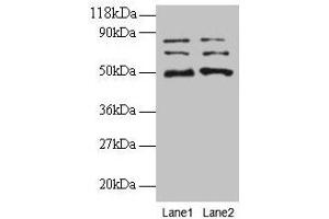 Western blot All lanes: VOPP1 antibody at 2 μg/mL Lane 1: EC109 whole cell lysate Lane 2: 293T whole cell lysate Secondary Goat polyclonal to rabbit IgG at 1/15000 dilution Predicted band size: 20, 19, 18 kDa Observed band size: 50, 70, 80 kDa (VOPP1 Antikörper  (AA 23-172))