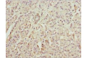 IHC analysis of paraffin-embedded human pancreatic tissue using ZFYVE1 antibody (1/100 dilution). (ZFYVE1 Antikörper  (AA 1-280))