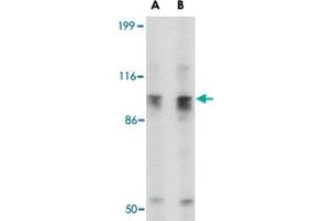 Western blot analysis of SLITRK6 in SK-N-SH cell lysate with SLITRK6 polyclonal antibody  at (A) 0.