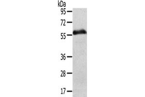 Gel: 8 % SDS-PAGE,Lysate: 40 μg,Lane: Human normal stomach tissue,Primary antibody: ABIN7192491(SLC43A2 Antibody) at dilution 1/200 dilution,Secondary antibody: Goat anti rabbit IgG at 1/8000 dilution,Exposure time: 5 minute (SLC43A2 Antikörper)