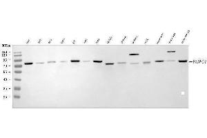 Western blot analysis of APP-1/PABPC4 using anti-APP-1/PABPC4 antibody (ABIN7603019).