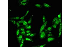 Immunofluorescent analysis of Hela cells using ABIN7155629 at dilution of 1:100 and Alexa Fluor 488-congugated AffiniPure Goat Anti-Rabbit IgG(H+L) (BBX Antikörper  (AA 62-292))