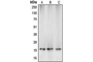 Western blot analysis of Caspase 5 p20 expression in MCF7 (A), mouse kidney (B), rat liver (C) whole cell lysates. (Caspase 5 p20 Antikörper  (Center))