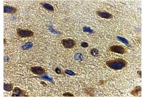 Immunohistochemistry (IHC) image for anti-Adiponectin (ADIPOQ) (C-Term) antibody (ABIN1030223) (ADIPOQ Antikörper  (C-Term))