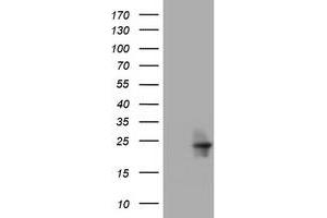 Image no. 1 for anti-Visinin-Like 1 (VSNL1) (AA 2-191) antibody (ABIN1491135) (VSNL1 Antikörper  (AA 2-191))