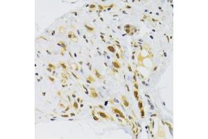 Immunohistochemistry of paraffin-embedded human stomach using RPL13 Antibody (ABIN2559760) at dilution of 1:100 (40x lens). (RPL13 Antikörper)