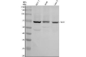 Western blot analysis of PAK4 using anti-PAK4 antibody (ABIN7825651).