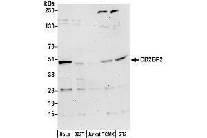 anti-CD2 (Cytoplasmic Tail) Binding Protein 2 (CD2BP2) (AA 275-325) antibody