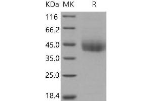 Western Blotting (WB) image for CD226 (CD226) (Active) protein (His tag) (ABIN7320356) (CD226 Protein (CD226) (His tag))