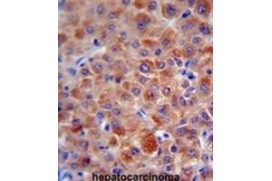 Immunohistochemistry (IHC) image for anti-Complement Factor H (CFH) antibody (ABIN5015561) (Complement Factor H Antikörper)