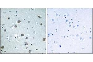Immunohistochemistry (IHC) image for anti-Guanine Nucleotide Binding Protein, alpha Stimulating, Olfactory Type (GNAL) (AA 41-90) antibody (ABIN1534968)