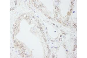 Immunohistochemistry (IHC) image for anti-Methyltransferase Like 3 (METTL3) (AA 530-580) antibody (ABIN7454413)