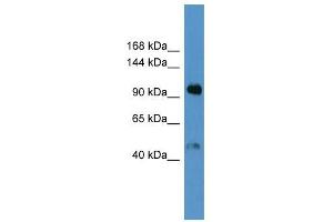 Western Blot showing Lp (a) antibody used at a concentration of 1-2 ug/ml to detect its target protein. (LPA Antikörper  (Middle Region))