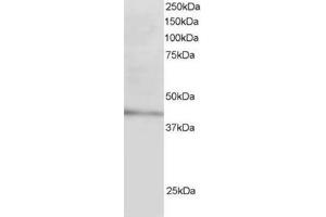 Image no. 1 for anti-Low Density Lipoprotein Receptor Adaptor Protein 1 (LDLRAP1) (N-Term) antibody (ABIN374338) (LDLRAP1 Antikörper  (N-Term))