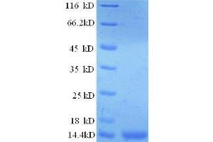 SDS-PAGE (SDS) image for Prostate Stem Cell Antigen (PSCA) (AA 21-95) protein (His tag) (ABIN1047564)