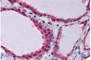 Thyroid, Human: Formalin-Fixed, Paraffin-Embedded (FFPE) (THRSP Antikörper)