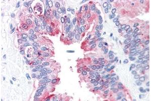 Human Prostate: Formalin-Fixed, Paraffin-Embedded (FFPE) (ADAM20 Antikörper  (Internal Region))