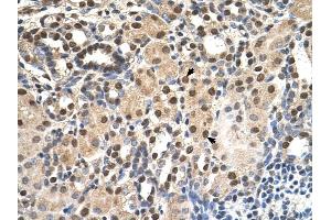 ANP32E antibody was used for immunohistochemistry at a concentration of 4-8 ug/ml to stain EpitheliaI cells of renal tubule (arrows) in Human Kidney. (ANP32E Antikörper)